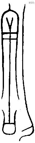 割字金文源流